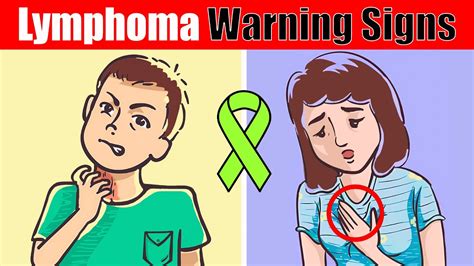 7 Warning Signs Of Lymphoma You Shouldnt Ignore Youtube