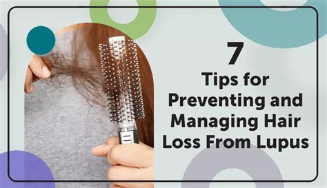 7 Tips For Preventing And Managing Hair Loss From Lupus Mylupusteam