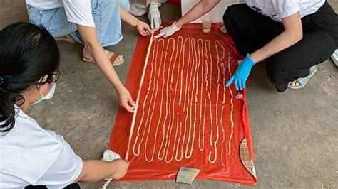 59 Foot Long Tapeworm Discovered Inside Thai Mans Intestines Viral News Zee News