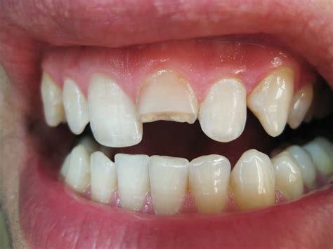 Simple Science: How to Make a Volcano with Kids