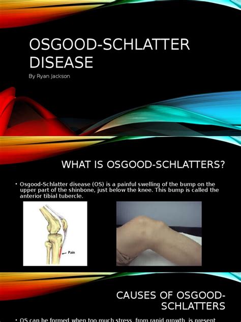 Osgood Schlatter Disease For Health Health Sciences Medical