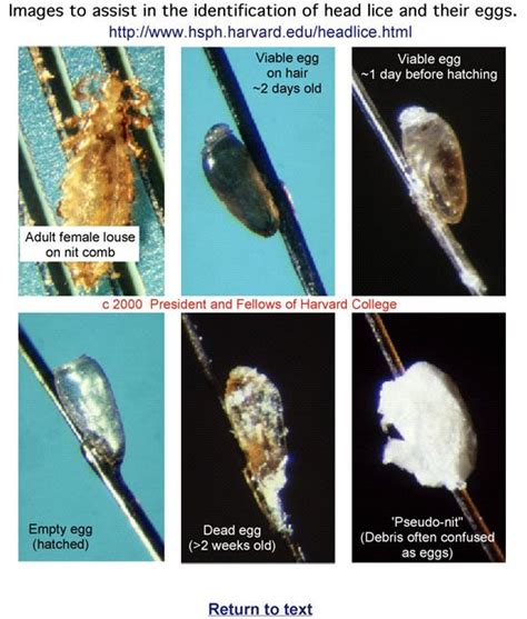 Stages Of Nits Of Head Lice Pictures Of Lice And Nits Pinterest