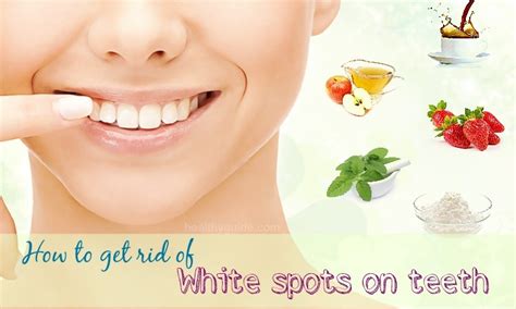 34 Tips How To Get Rid Of White Spots On Teeth Fast And Naturally