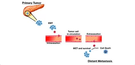 The Sequential Process Of Cancer Metastasis Metastasis Is A Complex