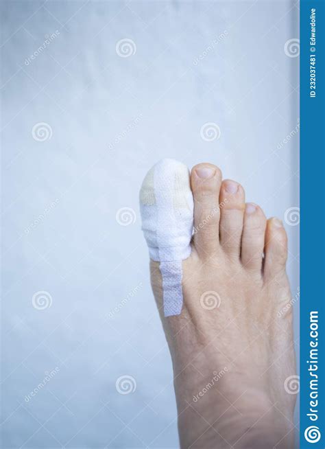 Foot Big Toe Bandage Injury Stock Image Image Of Injury Treatment