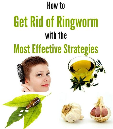 How To Get Rid Of Ringworm With The Most Effective Strategies Urban