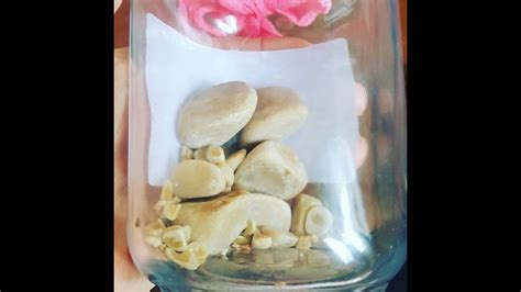 Calcium oxalate stones are difficult to prevent, as the cause of these stones is poorly understood in most cases. My Dogs Bladder Stones. - YouTube