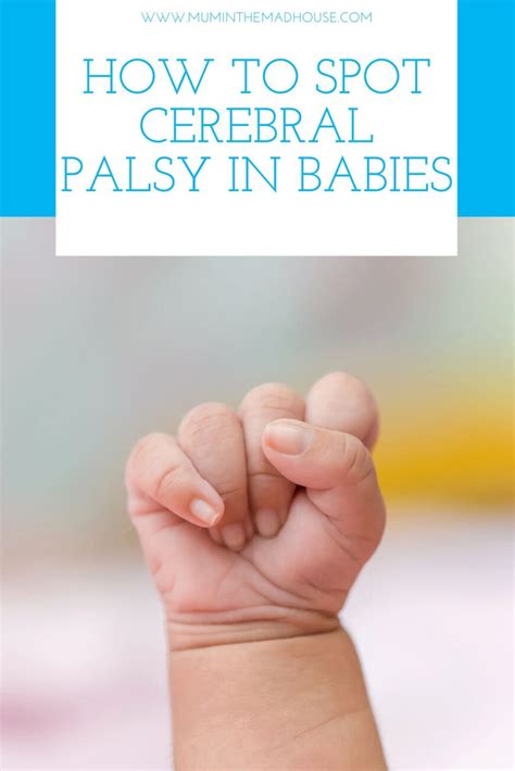 How To Spot Cerebral Palsy In Babies Mum In The Madhouse