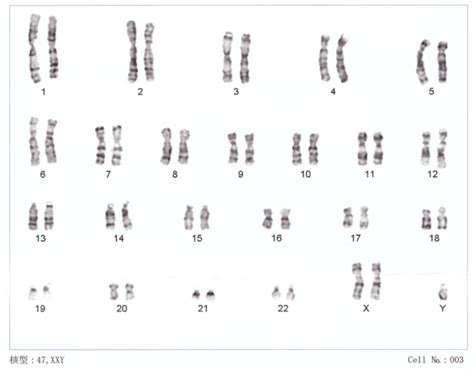 Abnormal Karyotype Vs Normal Karyotype