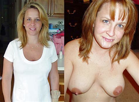 Before And After Facials 48 Pics Xhamster