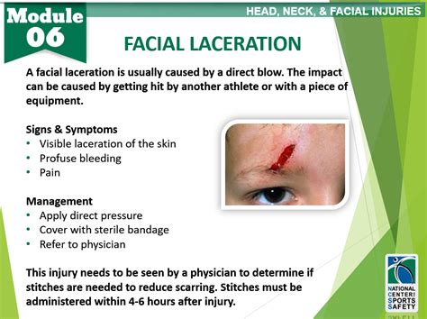 Facial Laceration National Center For Sports Safety