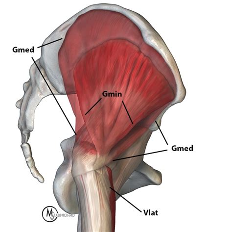 Gluteus Minimus Anatomy And Tear Patterns Radsource