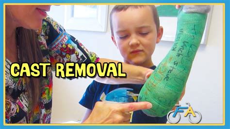 Full Arm Cast Removal Does It Hurt Youtube