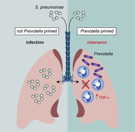 The Lung Microbiota Identifying Key Players To Improve Immune Mediated