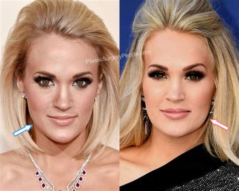 Carrie Underwood Before And After