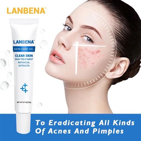 3pcs Acne Treatment Gel Acne Cleaning Face Cream Blackhead Remover Acne