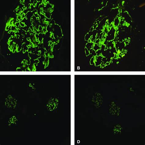 In Immunofluorescence Microscopic Examination In Kidney Biopsy With