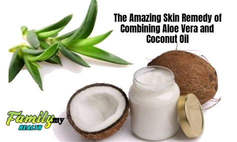 The Amazing Skin Remedy Of Combining Aloe Vera And Coconut Oil