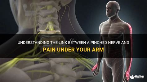 Understanding The Link Between A Pinched Nerve And Pain Under Your Arm