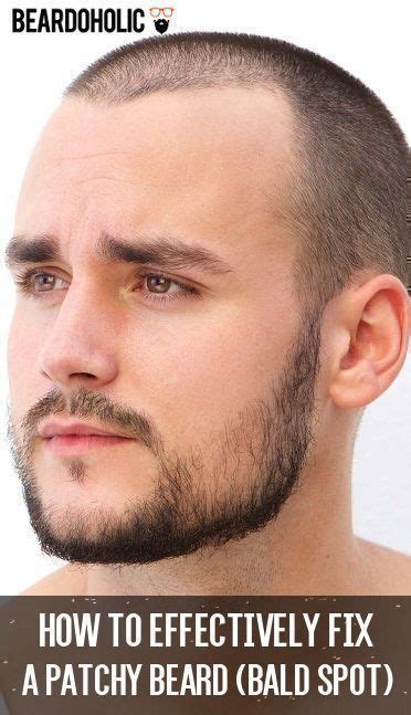 How To Effectively Fix A Patchy Beard Bald Spot Beardoholic Bald