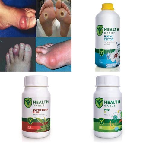 Healthgarde Gout Treatment Pack