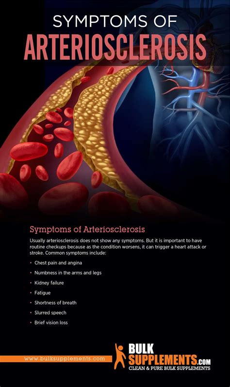 What Is Arteriosclerosis Symptoms Causes And Treatment