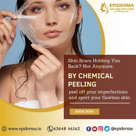 Ppt Best Chemical Peeling Treatment In Jayanagar Epiderma Clinic