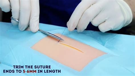 Simple Interrupted Suture Osce Guide Wound Suturing Geeky Medics
