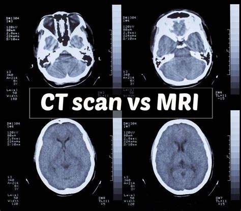 Difference Between Ct And Mri Scan 1000×875 Medical Ui Pinterest
