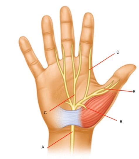 Carpal Tunnel Syndrome Hand Orthobullets
