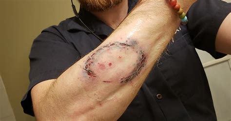 A Zombie Bite Tattoo Imgur