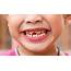 Are Your Children Embarrassed To Smile New Survey Reveals Concerns