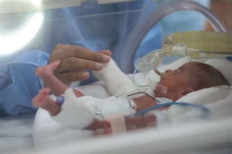 Día Mundial Del Niño Prematuro Cada Año Nacen 30 Mil Bebés Prematuros