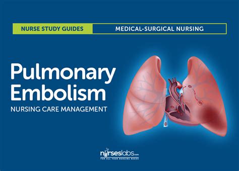 Pulmonary Embolism Nursing Care And Management Study Guide