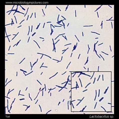 Lactobacillus Gram Stain And Cell Morphology Lactobacillus Micrograph
