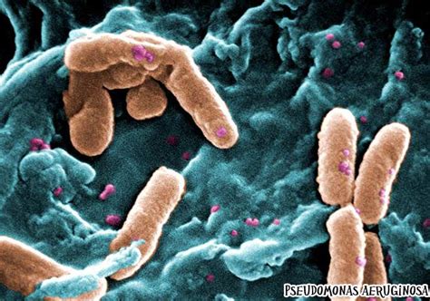 Bacterial Diseases Top 14 Most Deadliest Diseases Caused By Bacteria