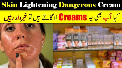 Dangers Of Skin Lightening Cream Youtube