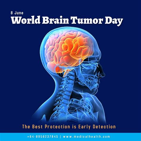 World Brain Tumor Day Template Postermywall