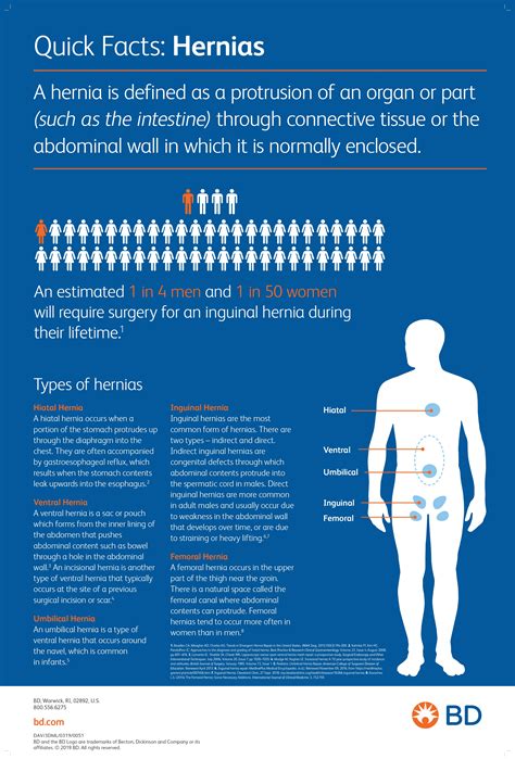 Hernia Infographic
