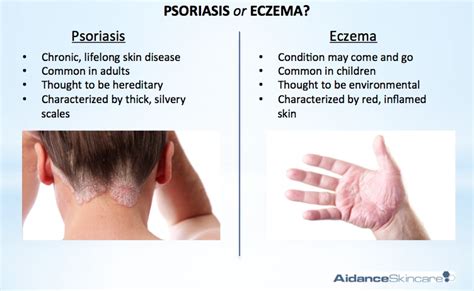 Difference Between Eczema And Psoriasis Dorothee Padraig South West