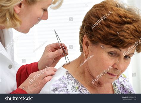 Doctor Removing Tick Tweezers Skin Patient Stock Photo 207839590