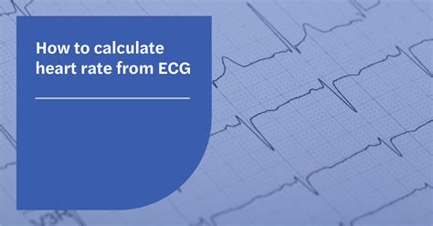 Ecg Calculation To Calculate Heart Rate From Ecg 8 Steps Pictures