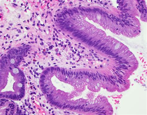 Histology Of Esophagus Labeled