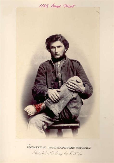 Civil War Portraits Of The Broken Bodies Sent Home Civil War Civil