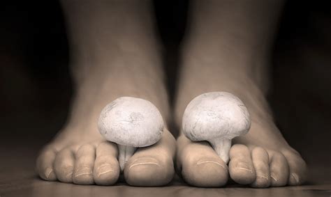 The foot, especially between the toes, provides the ideal environment for infection, allowing the roots of the fungus to penetrate damp, softened tissues. 7 Ways to Treat Toenail Fungus Naturally & Effectively