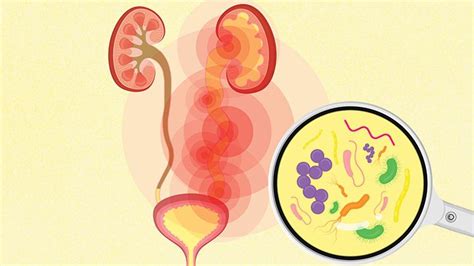 An infection that affects parts of the body that…. Urinary Tract Infections or UTIs: What to Know About ...