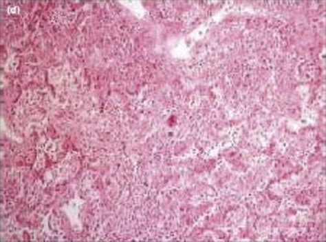 Pathologic consequences of infection - The conflicts - Medical Microbiology