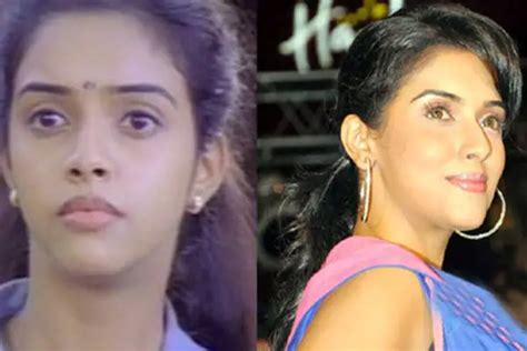 bollywood actresses before and after plastic surgery images
