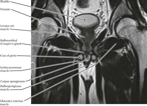 This is the sixth in a series of 8 blog post articles on the anatomy and physiology of the lumbar spine and pelvis. Pelvis and Perineum | Radiology Key