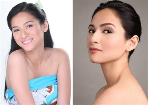 Philippine Actresses That Have Undergone Surgery Gossip Ghirl